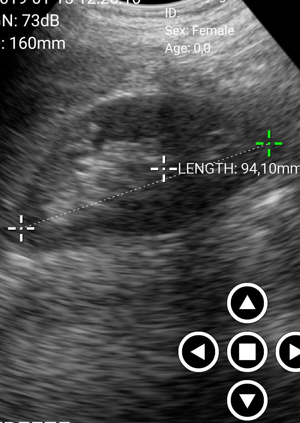 PulseEcho Wireless Ultrasound Scanner